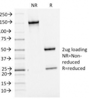 SDS-PAGE analysis of purified, BSA-free Bcl6 antibody (clone BCL6/1475). Confirmation of integrity and purity of the antibody.