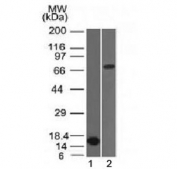 Western blot testing of 1) partial recombinant protein and 2) human HepG2 lysate with Bcl6 antibody (clone BCL6/1475). Expected molecular weight: 78/95 kDa (non-phosphorylated/phosphorylated).