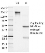 SDS-PAGE analysis of purified, BSA-free Bcl6 antibody (clone BCL6/1527) as confirmation of integrity and purity.