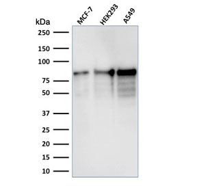 Western blot testing of human samples with MCM7 antibody (clone MCM7/1467). Expected molecular weight: 80-90 kDa.~