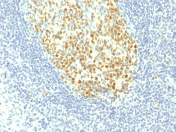 IHC testing of FFPE human tonsil with MCM7 antibody (clone MCM7/1467). Required HIER: boil tissue sections in pH 9 10mM Tris with 1mM EDTA for 10-20 min.~