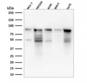 Western blot testing of human samples with MCM7 antibody (clone MCM7/1469). Expected molecular weight: 80-90 kDa.