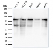 Western blot testing of human samples with MCM7 antibody (clone MCM7/1468). Expected molecular weight: 80-90 kDa.