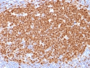 IHC testing of FFPE human tonsil with MCM7 antibody (clone MCM7/1468). Required HIER: boil tissue sections in pH 9 10mM Tris with 1mM EDTA for 10-20 min.