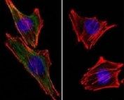 (Left) Confocal Immunofluorescent analysis of A2058 cells using AF488-labeled S100 beta antibody (green). F-actin filaments were labeled with DyLight 554 Phalloidin (red). DAPI was used to stain the cell nuclei (blue). (Right) Negative control.