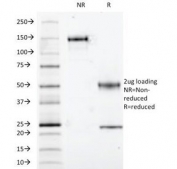 SDS-PAGE Analysis of Purified, BSA-Free S100 beta Antibody (clone S100B/1012). Confirmation of Integrity and Purity of the Antibody.
