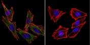 (Left) Confocal Immunofluorescent analysis of A2058 cells using S100 beta antibody (green). F-actin filaments were labeled with DyLight 554 Phalloidin (red). DAPI was used to stain the cell nuclei (blue). (Right) Negative control.