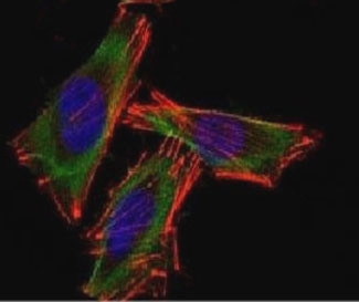 Confocal Immunofluorescent analysis of A2058 cells using Alexa Fluor 488-labeled S100B antibody (green). F-actin filaments were labeled with DyLight 554 Phalloidin (red). DAPI was used to stain the cell nuclei (blue).~