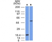 Western blot testing of A) partial recombinant protein B) A375 cell lysate using SOX10 antibody (SOX10/991). Predicted molecular weight ~50 kDa.