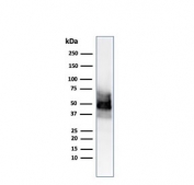 Western blot testing of human COLO-38 cell lysate using SOX10 antibody (SOX10/991). Predicted molecular weight ~50 kDa.