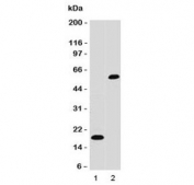 Western blot testing of 1) partial recombinant protein and 2) A375 cell lysate using SOX10 antibody. Predicted molecular weight ~50 kDa.