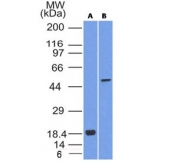 Western blot testing of A) partial recombinant protein; B) A375 cell lysate using SOX-10 antibody (SOX10/1074). Predicted molecular weight ~50 kDa.