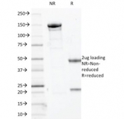 SDS-PAGE analysis of purified, BSA-free SOX-10 antibody (clone SOX10/1074) as confirmation of integrity and purity.