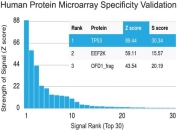 Protein array validation of the TP53 antibody: Analysis of HuProt(TM) microarray containing more than 19,000 full-length human proteins using TP53 antibody (clone TRP/816).  Z- and S- score: The Z-score represents the strength of a signal that an antibody (in combination with a fluorescently-tagged anti-IgG secondary Ab) produces when binding to a particular protein on the HuProt(TM) array. Z-scores are described in units of standard deviations (SD's) above the mean value of all signals generated on that array. If the targets on the HuProt(TM) are arranged in descending order of the Z-score, the S-score is the difference (also in units of SD's) between the Z-scores. The S-score therefore represents the relative target specificity of an Ab to its intended target. 