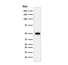Western blot testing of human HeLa cell lysate with TP53 antibody (clone TRP/816).~