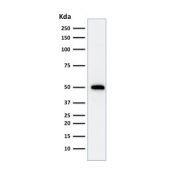Western blot testing of human HeLa cell lysate with TP53 antibody (clone TRP/816).