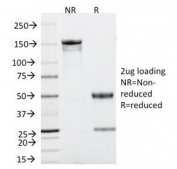 SDS-PAGE analysis of purified, BSA-free TP53 antibody (clone TRP/816) as confirmation of integrity and purity.