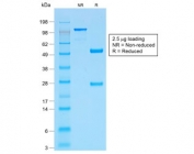 SDS-PAGE analysis of purified, BSA-free recombinant p53 antibody (clone TP53/1799R) as confirmation of integrity and purity.