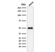 Western blot testing of human HeLa cell lysate with recombinant p53 antibody (clone TP53/1799R).