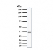 Western blot testing of human HeLa cell lysate with TYMS antibody (clone TYMS/1884). Predicted molecular weight ~36 kDa.