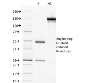 SDS-PAGE analysis of purified, BSA-free TYMS antibody (clone TYMS/1884) as confirmation of integrity and purity.