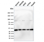 Western blot testing of human cell lysates with Prohibitin antibody (clone PHB/1881). Expected molecular weight ~30 kDa.