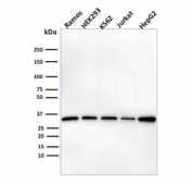 Western blot testing of human cell lysates with PHB antibody (clone PHB/1882). Expected molecular weight ~30 kDa.