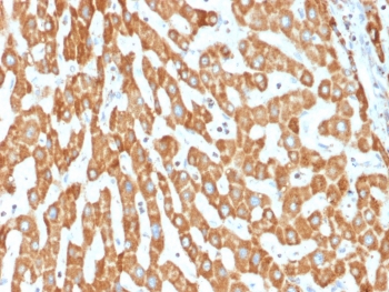 IHC testing of FFPE human liver tissue with PHB antibody (clone PHB/1882). Required HIER: boil tissue sections in pH6, 10mM citrate buffer, for 10-20 min followed by cooling at RT for 20 min.~