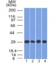 Western blot testing of human 1) A549, 2) K562, 3) A431 and 4) MCF7 cell lysate with PHB antibody (clone PHB/1882). Expected molecular weight ~30 kDa.