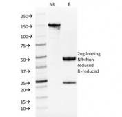 SDS-PAGE analysis of purified, BSA-free TYRP1 antibody (clone TYRP1/1986) as confirmation of integrity and purity.