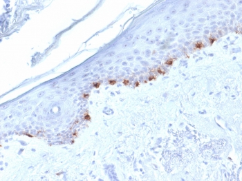 IHC testing of FFPE human skin with TYRP1 antibody (clone TYRP1/1986). HIER: boil tissue sections in pH6, 10mM citrate buffer, for 10-20 min followed by cooling at RT for 20 min.~