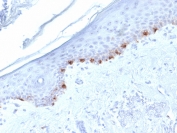 IHC testing of FFPE human skin with TYRP1 antibody (clone TYRP1/1986). HIER: boil tissue sections in pH6, 10mM citrate buffer, for 10-20 min followed by cooling at RT for 20 min.