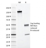 SDS-PAGE analysis of purified, BSA-free anti-EpCAM antibody (clone EGP40/1372) as confirmation of integrity and purity.