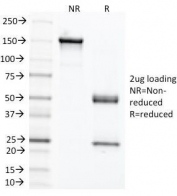 SDS-PAGE analysis of purified, BSA-free CEA antibody (clone C66/1291) as confirmation of integrity and purity.
