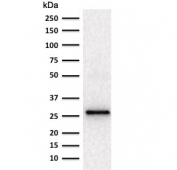 Western blot testing of human kidney lysate with Adiponectin antibody (clone ADPN/1370). Routinely observed at 26~30 kDa.