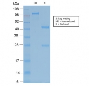 SDS-PAGE analysis of purified, BSA-free recombinant TRAcP antibody (clone ACP5/2336R) as confirmation of integrity and purity.
