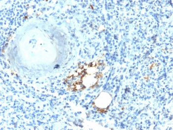 IHC testing of FFPE human spleen with recombinant TRAcP antibody (clone ACP5/2336R). Required HIER: boil tissue sections in 10mM citrate buffer, pH 6.0, for 10-20 min followed by cooling at RT for 20 min.~