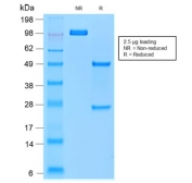 SDS-PAGE analysis of purified, BSA-free recombinant TRAcP antibody (clone rACP5/1070) as confirmation of integrity and purity.