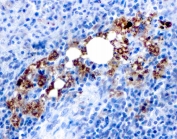 IHC testing of FFPE human spleen with recombinant TRAcP antibody (clone rACP5/1070).  Required HIER: boil tissue sections in 10mM citrate buffer, pH 6.0, for 10-20 min followed by cooling at RT for 20 min.
