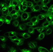 Immunofluorescent staining of permeabilized human HeLa cells with recombinant Beta-2 Microglobulin antibody (clone rB2M/961).
