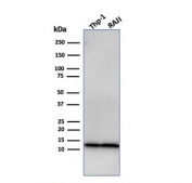 Western blot testing of human THP-1 and Raji cell lysate with recombinant Beta-2 Microglobulin antibody. Expected molecular weight: 12-14 kDa.