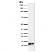 Western blot testing of human Raji cell lysate with recombinant B2M antibody (clone B2M/1857R). Expected molecular weight: 12-14 kDa.