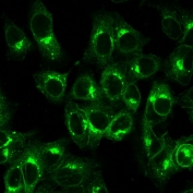 Immunofluorescent staining of PFA-fixed human HeLa cells with recombinant B2M antibody (clone B2M/1857R).
