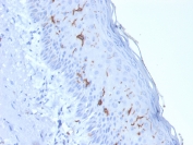 IHC testing of FFPE human skin with recombinant CD1a antibody (clone rC1A/711). Required HIER: boil tissue sections in 10mM citrate buffer, pH 6, for 10-20 min.
