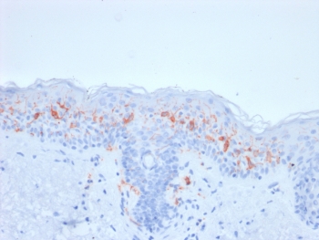 IHC testing of FFPE human skin with recombinant CD1a antibody (clone rC1A/711). Required HIER: boil tissue sections in 10mM citrate buffer, pH 6, for 10-20 min.~
