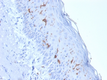 IHC testing of FFPE human skin with recombinant CD1a antibody (clone rC1A/7