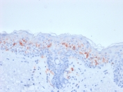 IHC testing of FFPE human skin with recombinant CD1a antibody (clone rC1A/711). Required HIER: boil tissue sections in 10mM citrate buffer, pH 6, for 10-20 min.