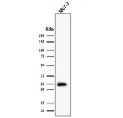 Western blot testing of  human MCF7 cell lysate with recombinant Bcl2 antibody (clone BCL2/1878R). Expected molecular weight ~26 kDa.