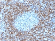 IHC testing of FFPE human tonsil tissue with recombinant Bcl2 antibody (clone BCL2/1878R). HIER: boil tissue sections in 1mM EDTA buffer, pH8, for 10-20 min followed by cooling at RT for 20 min.