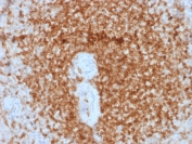 IHC testing of FFPE human spleen tissue with recombinant Bcl-2 antibody (rBCL2/796). HIER: boil tissue sections in 10mM Tris with 1mM EDTA, pH 7.5-8.5, for 10-20 min followed by cooling at RT for 20 min.